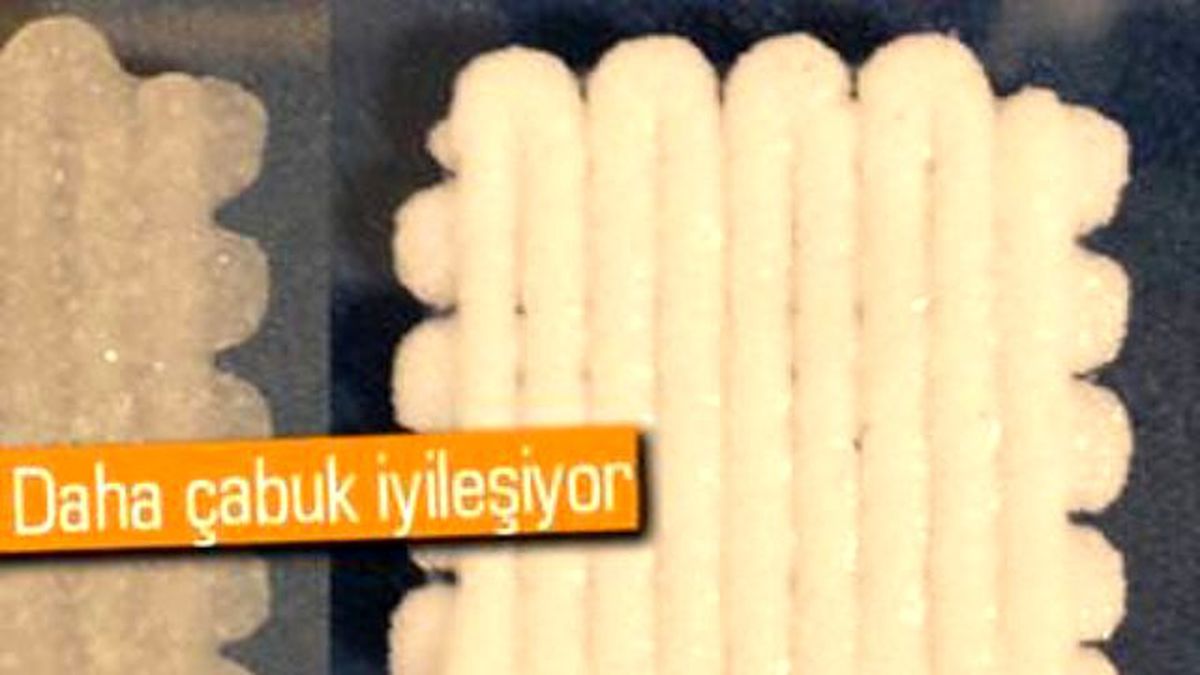 3d Baskılı Hamur, Kırılan Kemikleri Tedavi Edebiliyor