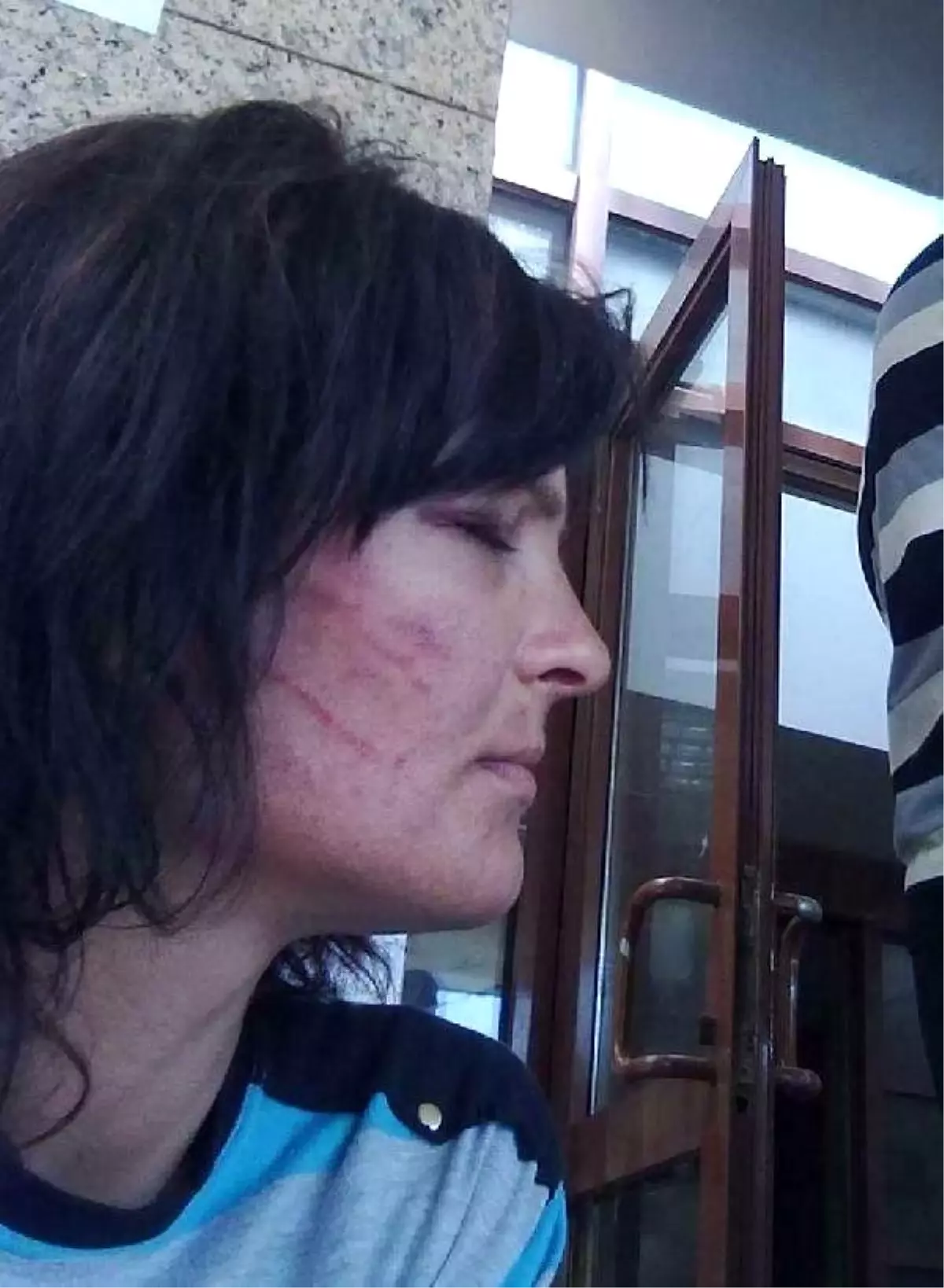 Doctor Fined Over İnaccurate Report On Tortured Woman İn Turkey\'s West