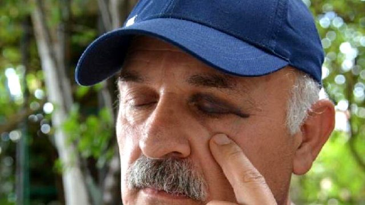 Diş Hekimine, Hastasına Yumruklu Saldırı Suçlaması