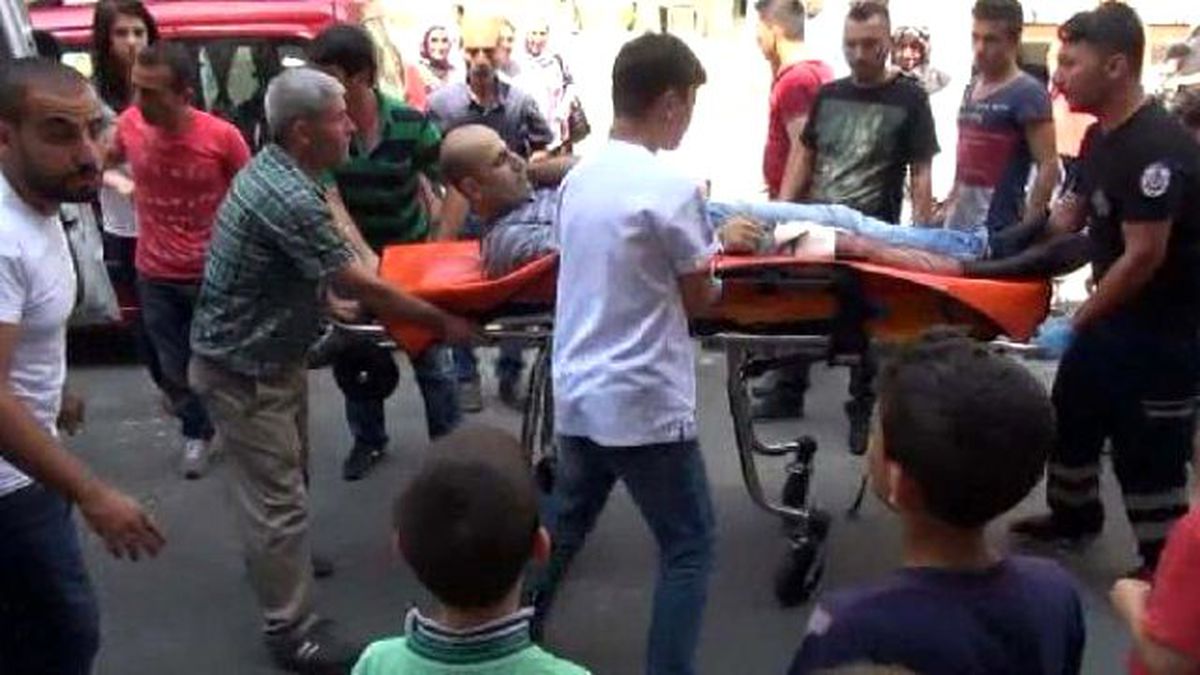 Kazayla Bacağını Kesti; Ağlayan Oğlunu Teselli Etmeye Çalıştı
