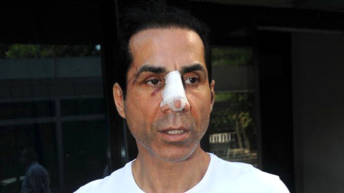 CHP'li Belediye Meclis Üyesini Döven 3 Kişi Serbest