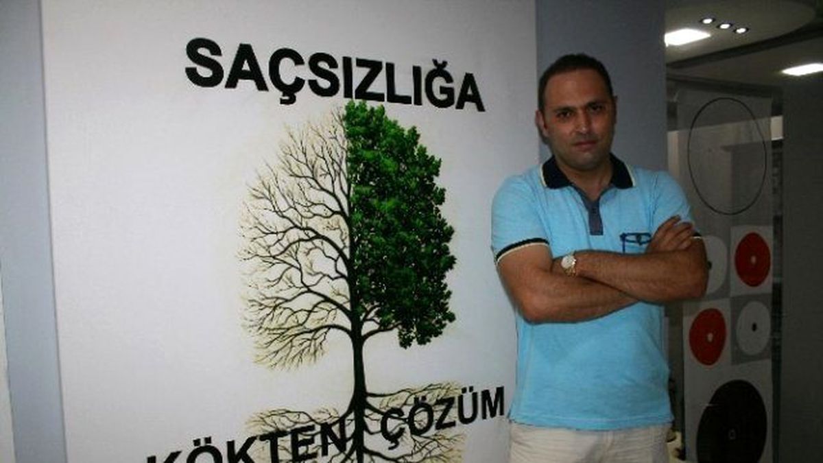 Genç Siyasetçi Saç Ektirdi