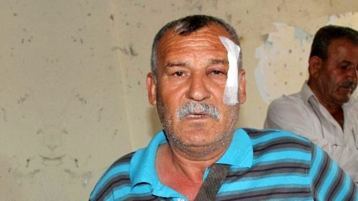 İki Bombalı Saldırıdan Sağ Kurtuldu