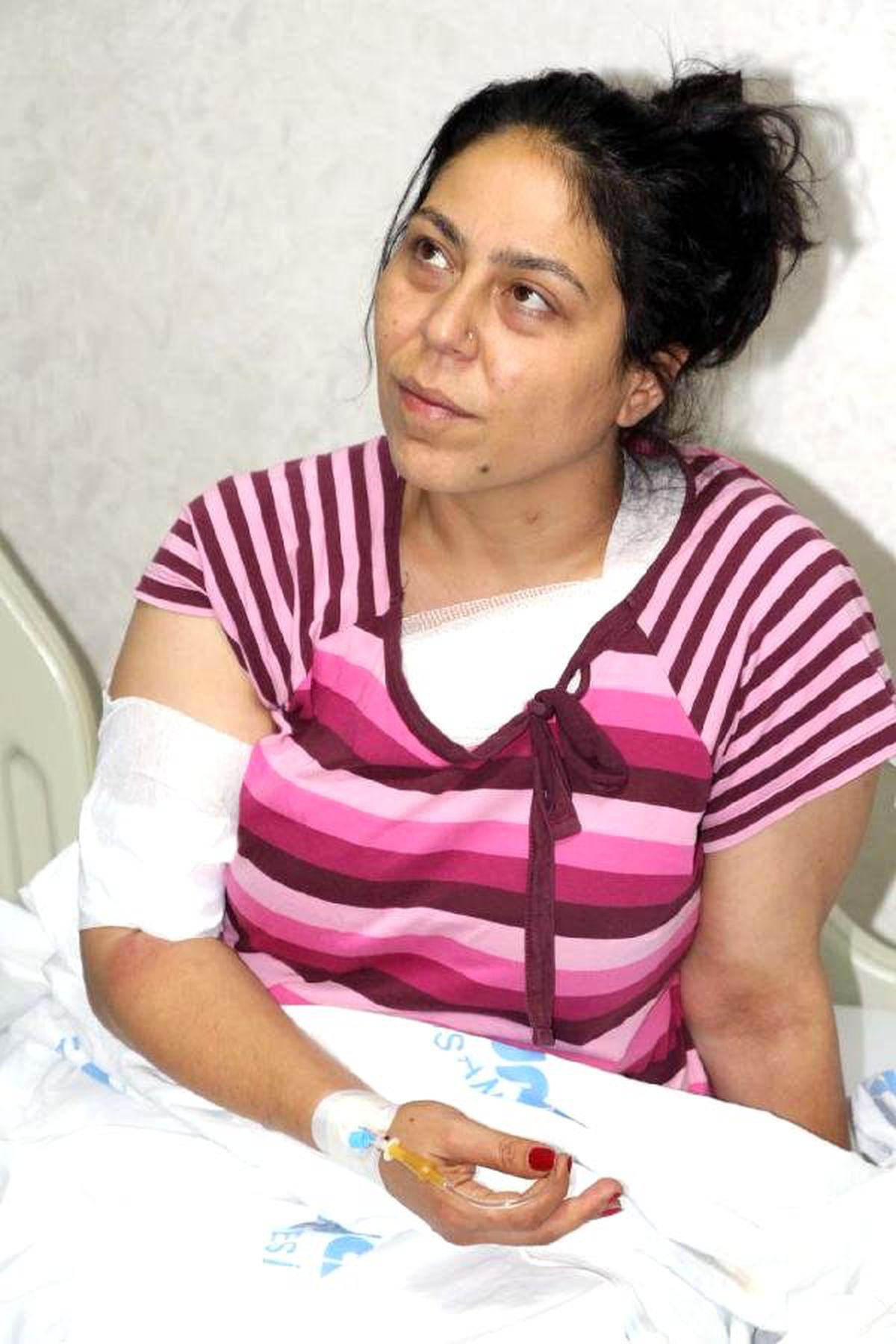 Suruç'ta Yaralanan HDP'li, Patlama Anını Anlattı