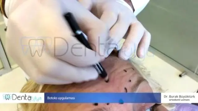 Dis Hekimi Ve Ortodonti Uzmani Dr Burak Dent B B Dis Klinigi Facebook