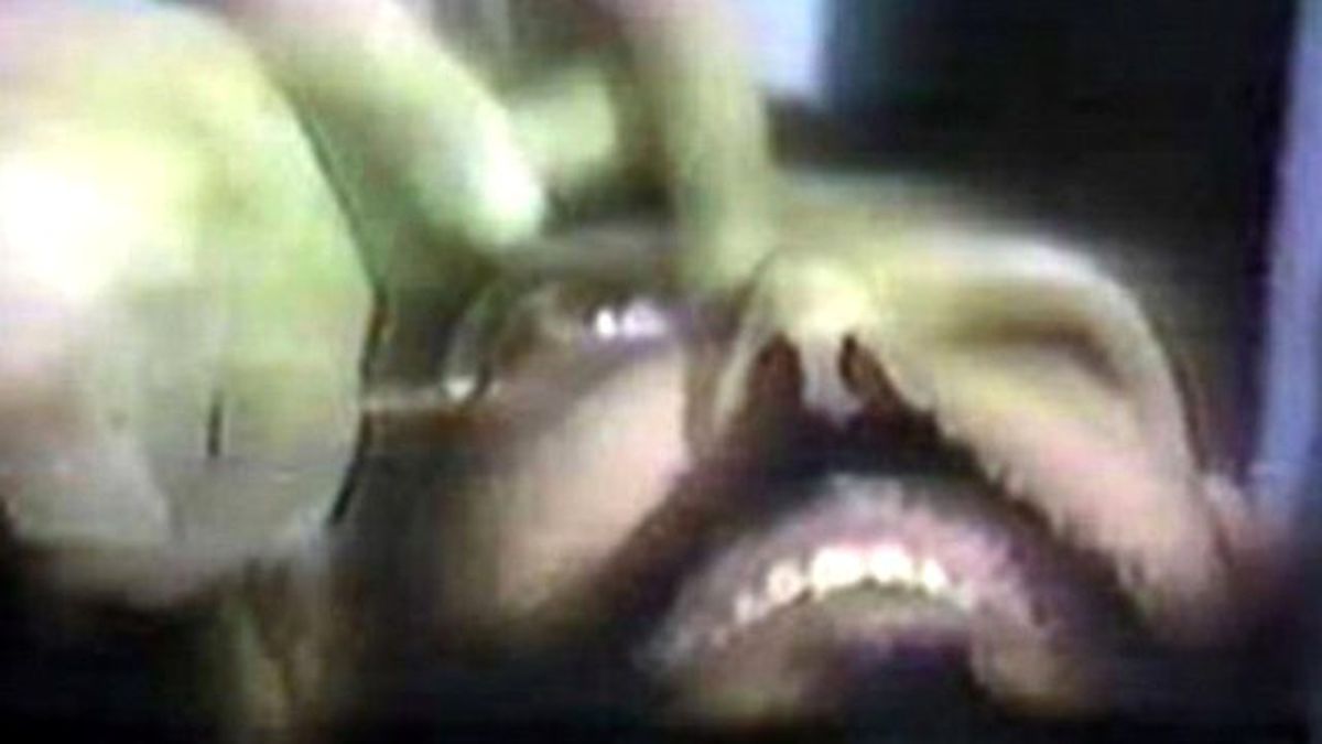 Mahkeme, Arkadaşının Gözünü Çıkaran Adama Aynı Cezayı Verdi