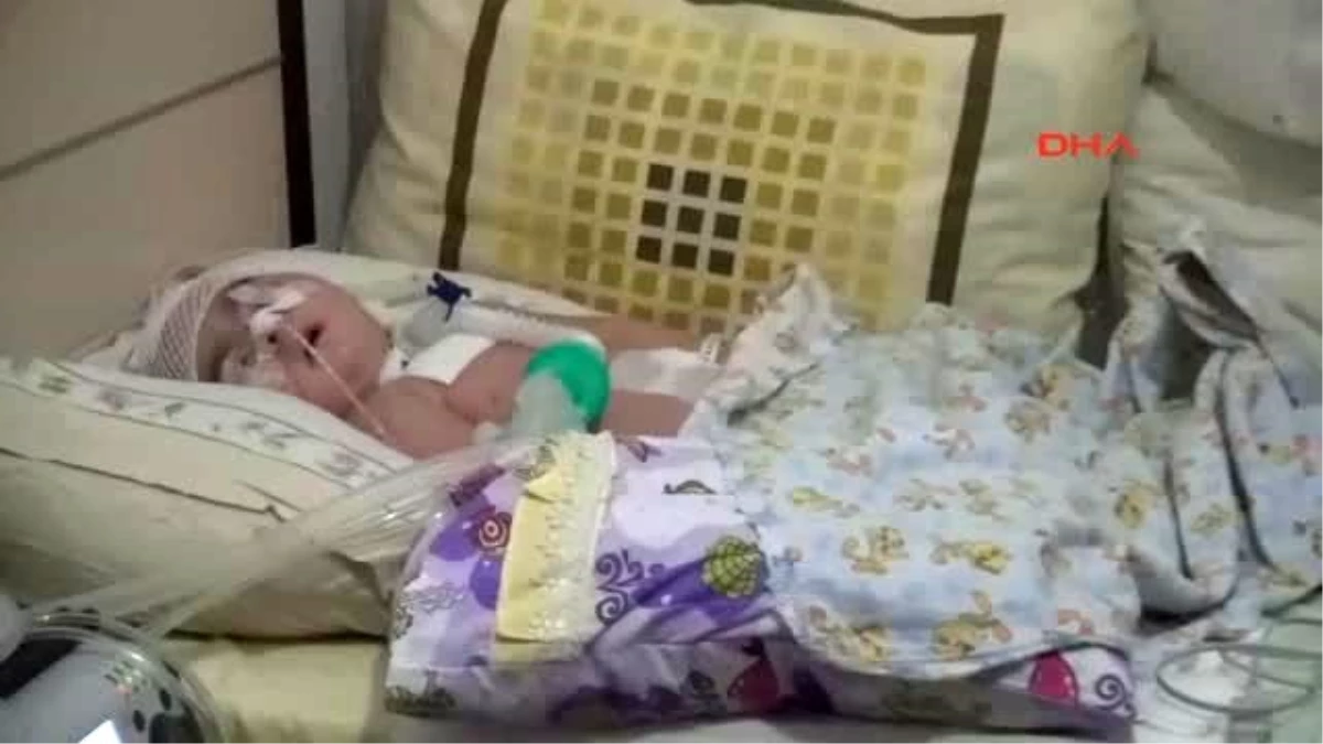 Sakarya - Azra Bebek 3 Aydır Solunum Cihazına Bağlı Olarak Yaşıyor