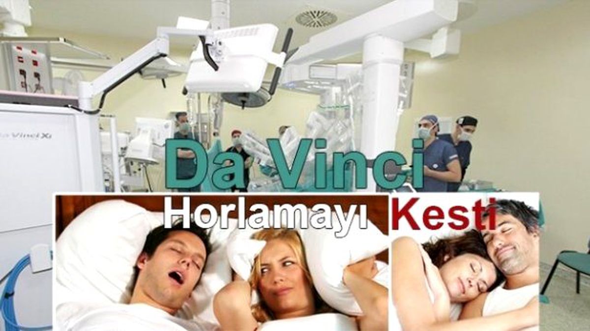 Da Vinci Ameliyat Robotu Horlamayı Kesti