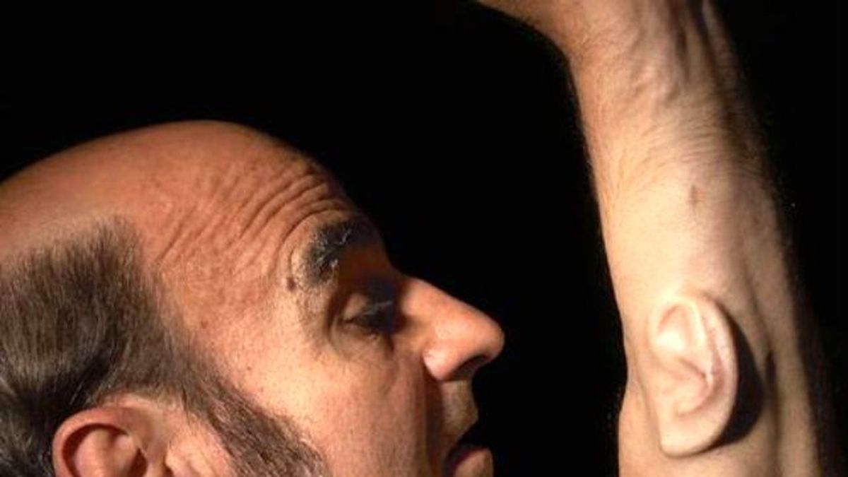 Çılgın Sanatçı, Koluna 3. Kulağını Yaptırdı