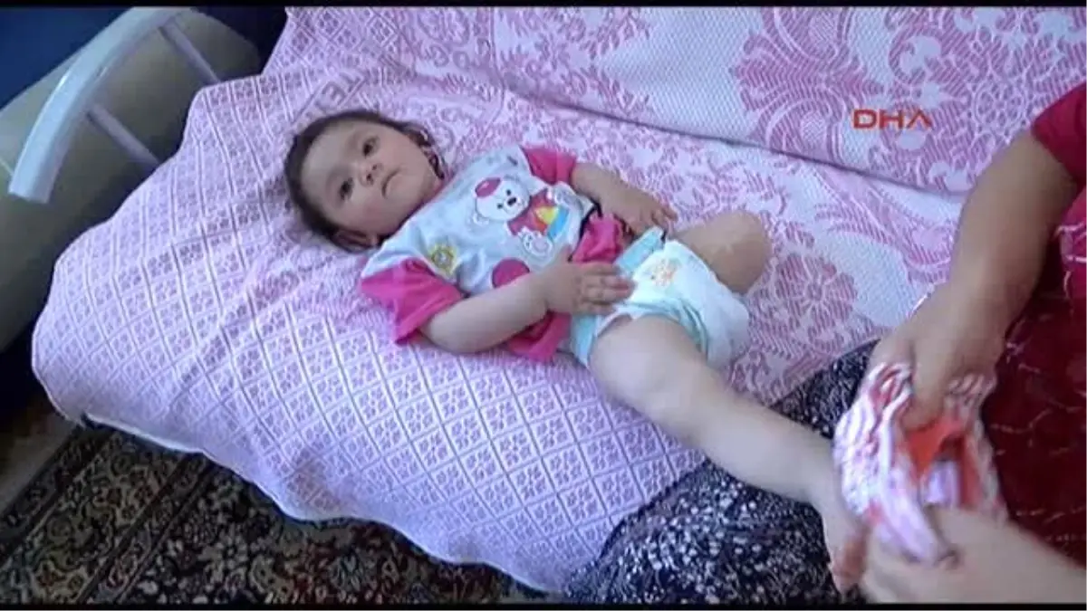 Kızının Bacağı Kesilen Baba: Büyüyünce Ona Bunu Nasıl Anlatırım