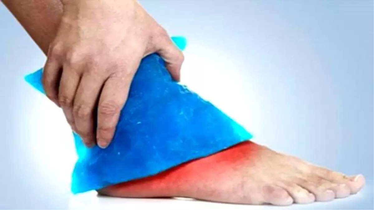 Deniz Canlısı Sokmasına Ne İyi Gelir