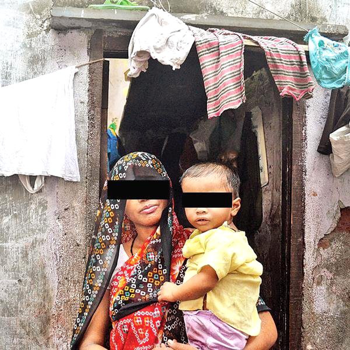 Üç Penisle Dünyaya Gelen Çocuğa 6 Saatlik Operasyon