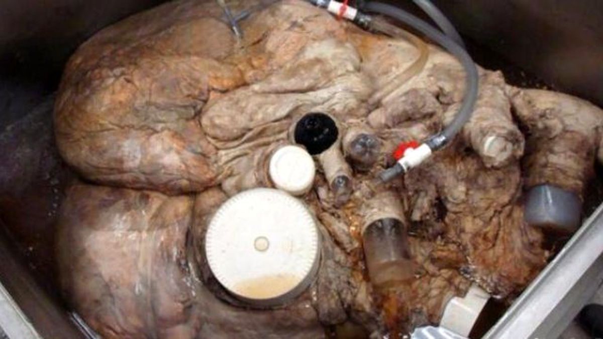 Kıyıya Vuran Balığın Kalbi Bir Araba Boyunda