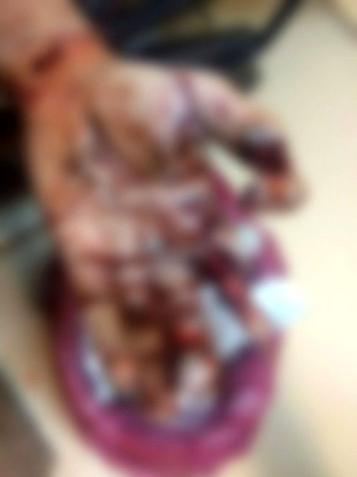 Polise Atmak İstediği Patlayıcı Elinde Patladı