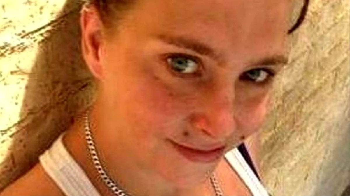 "Çamaşır Suyuyla Yıkan" Tavsiyesi Egzama Hastası Genç Kızı Öldürüyordu