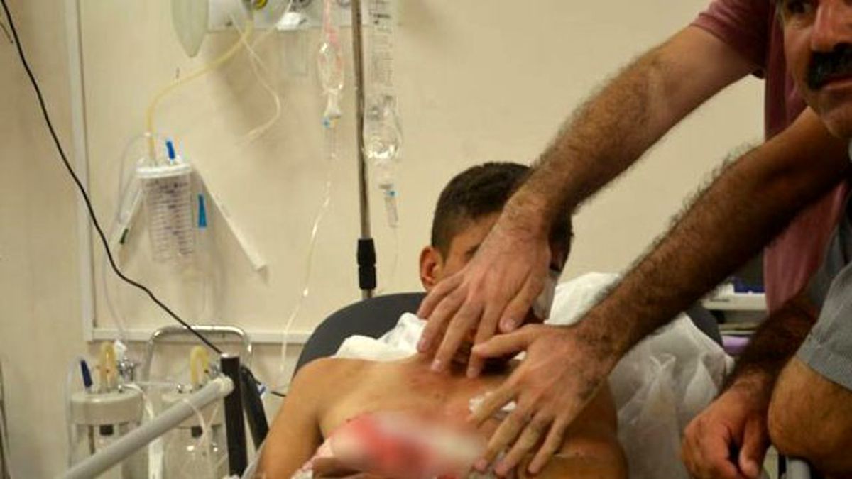 Polise Atmak İstediği Bomba Elinde Patladı