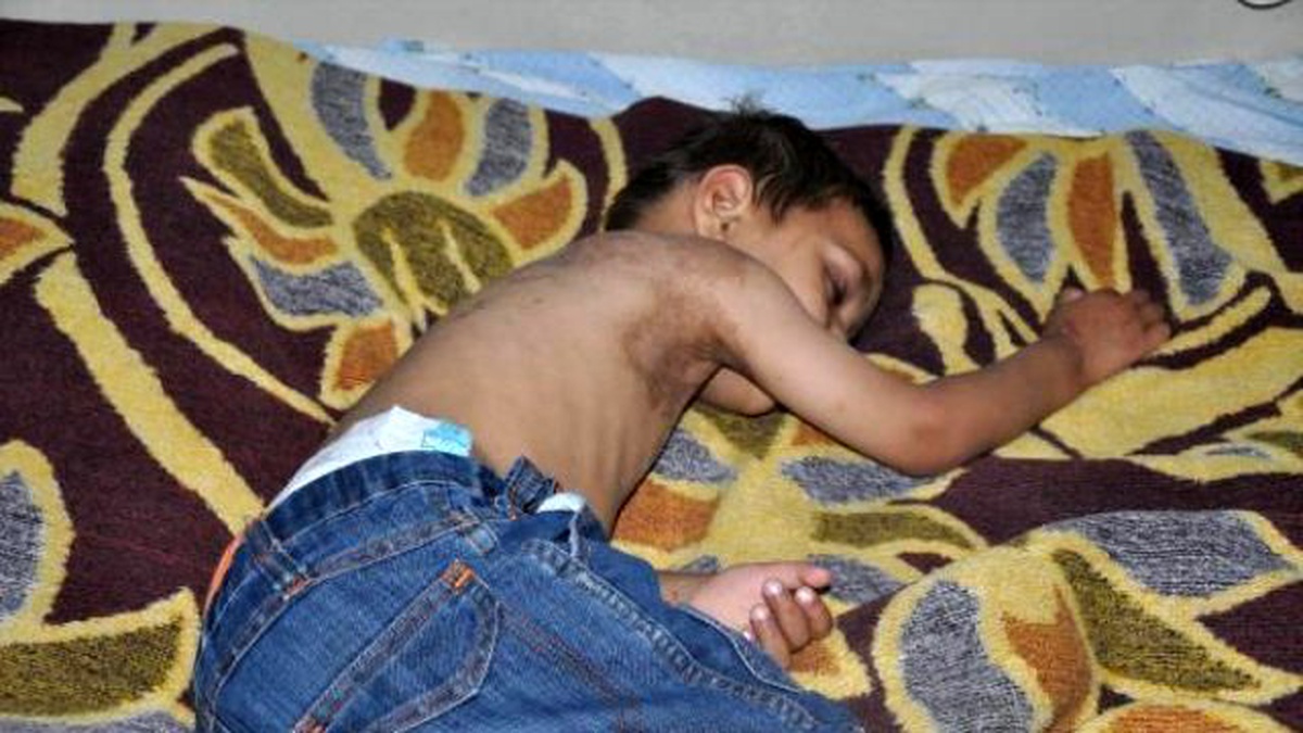 IŞİD\'in Bombasıyla Yaralanan Suriyeli Aile İnegöl\'e Geri Döndü