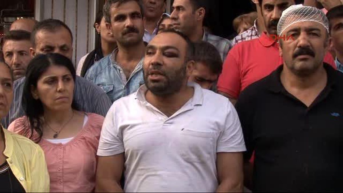 Hdp\'den Dayak İddiası...