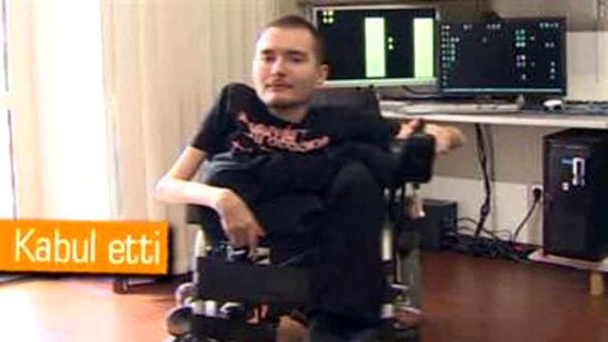 Dünyanın İlk Kafa Naklinde Yeni Gelişme