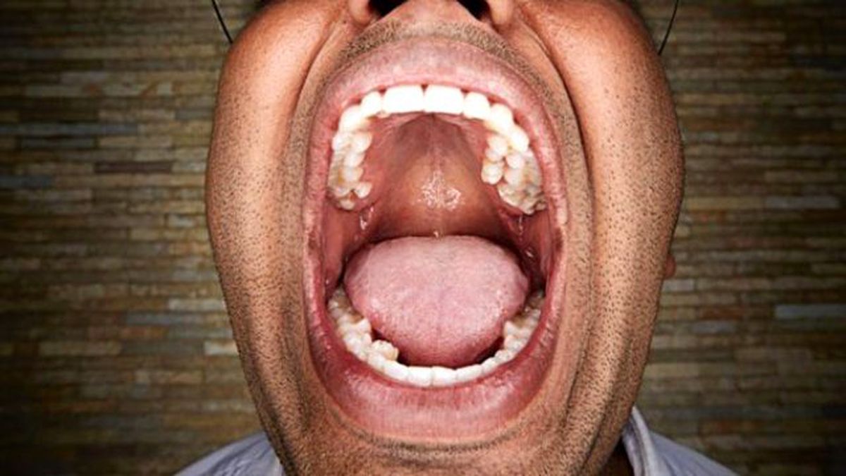 Hintli Adam 37 Tane Dişiyle Rekor Kırdı