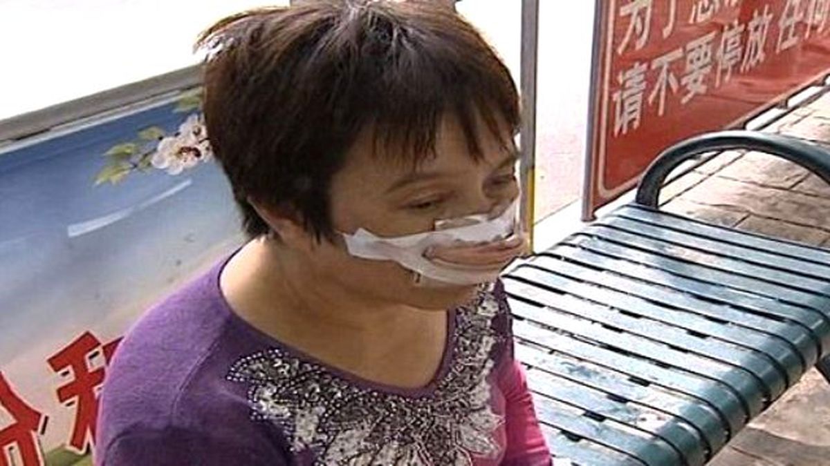 Çinli Adam Karısının Burnunu Isırıp, Yuttu!