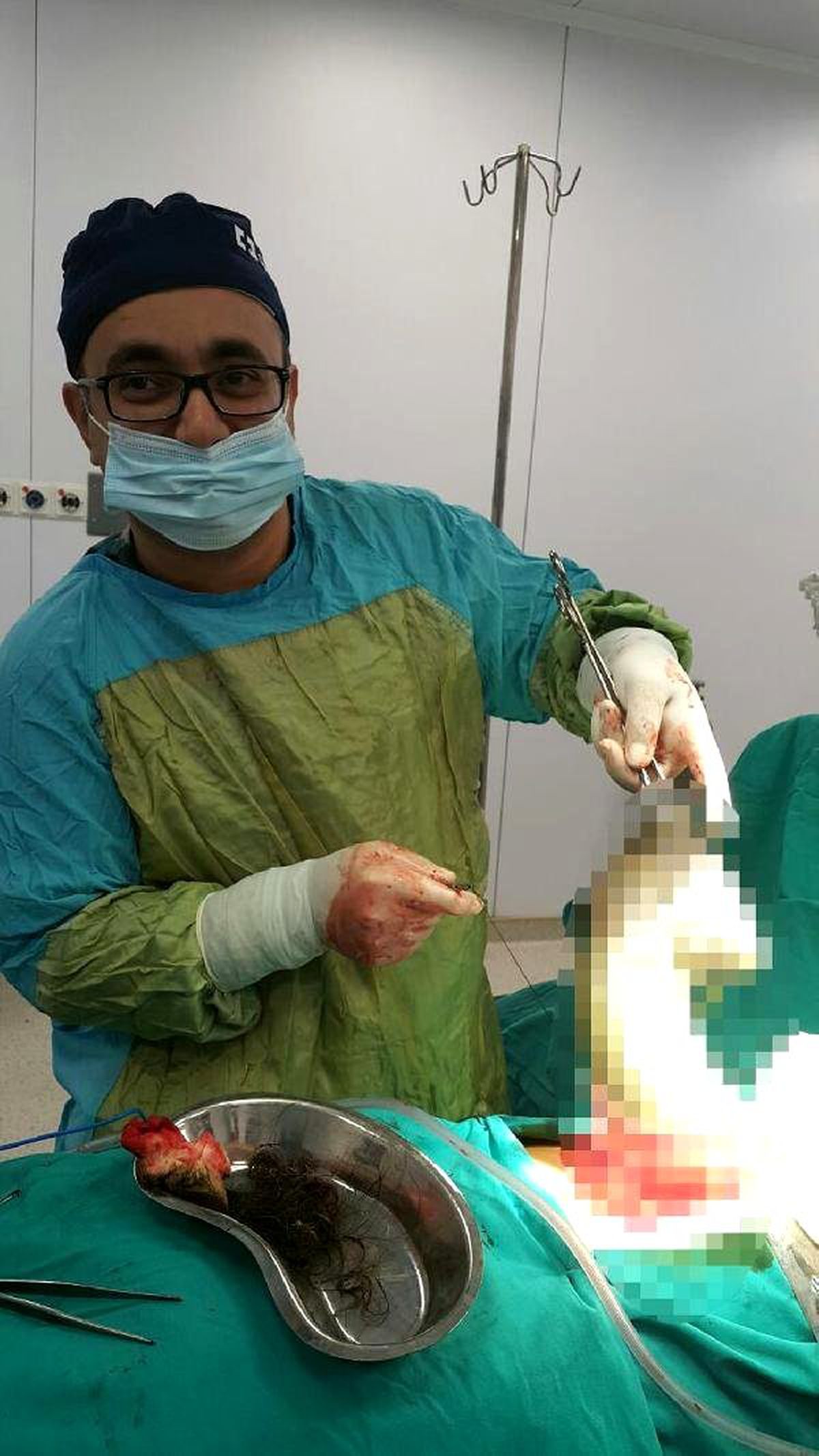 Genç Kızın Midesinden 1.5 Kilogram Saç Çıkarıldı