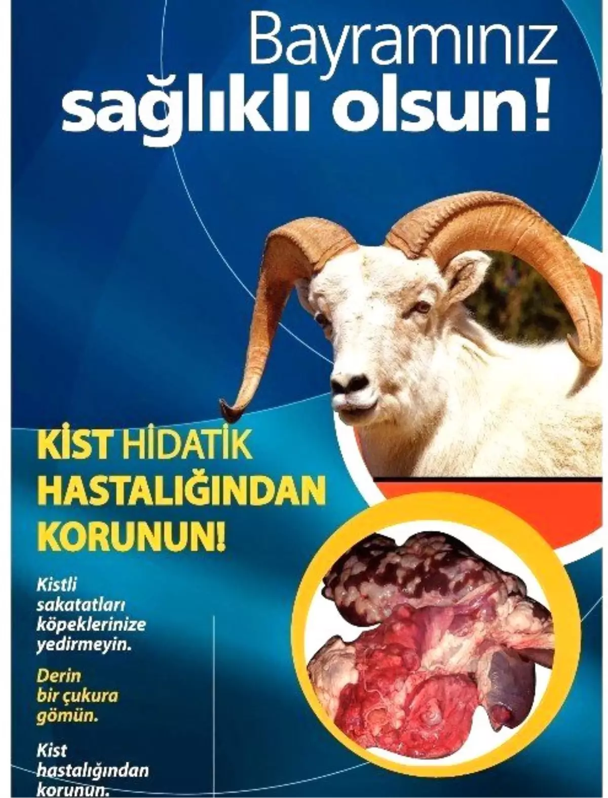 Kurban Bayramında Kist Hastalığına Dikkat