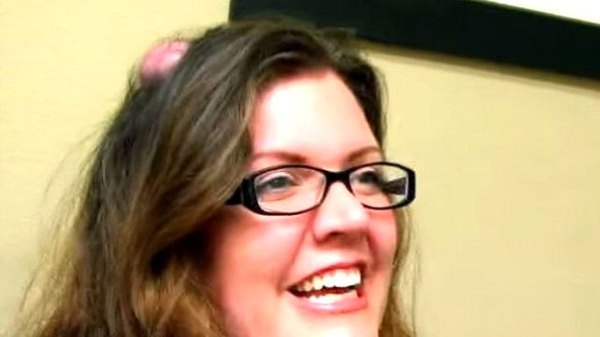 Canlı Yayında 20 Yıllık Kistinden Kurtuldu