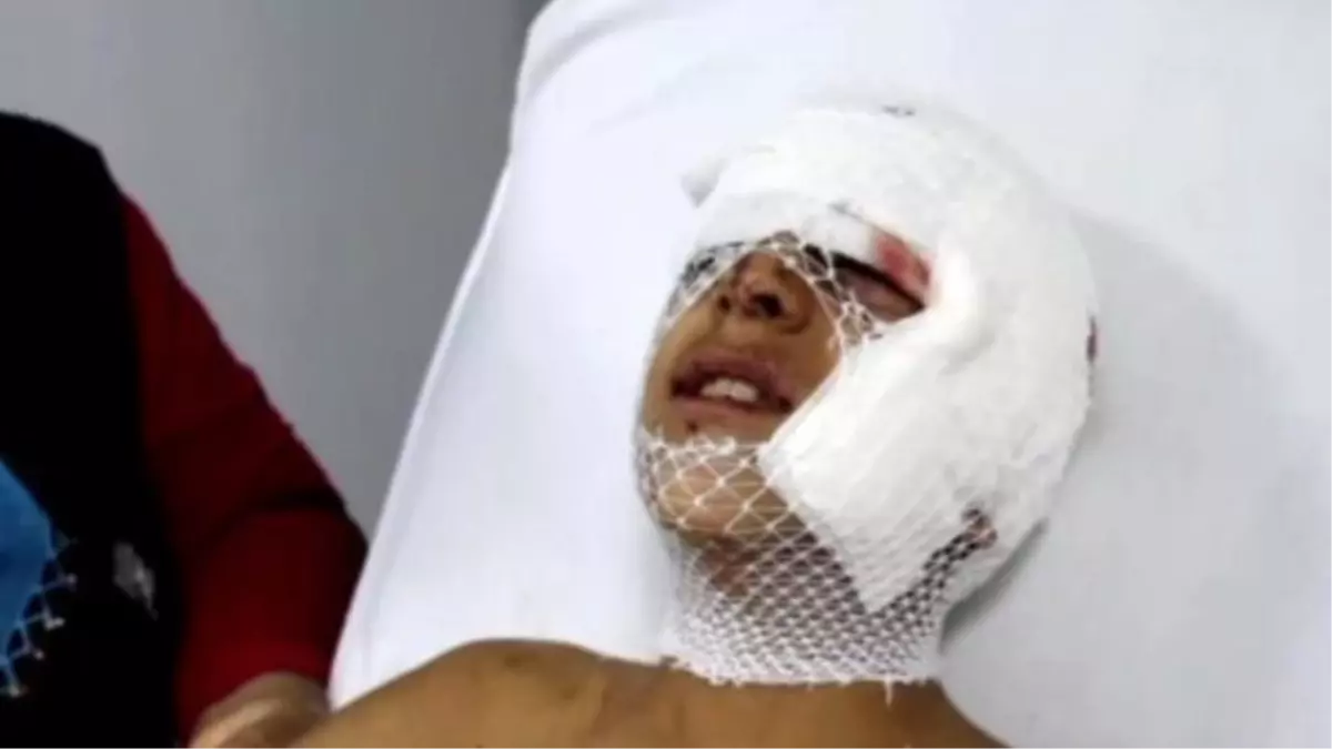 Samsun'da Köpek Tarafından Isırılan Çocuk Ölümden Döndü