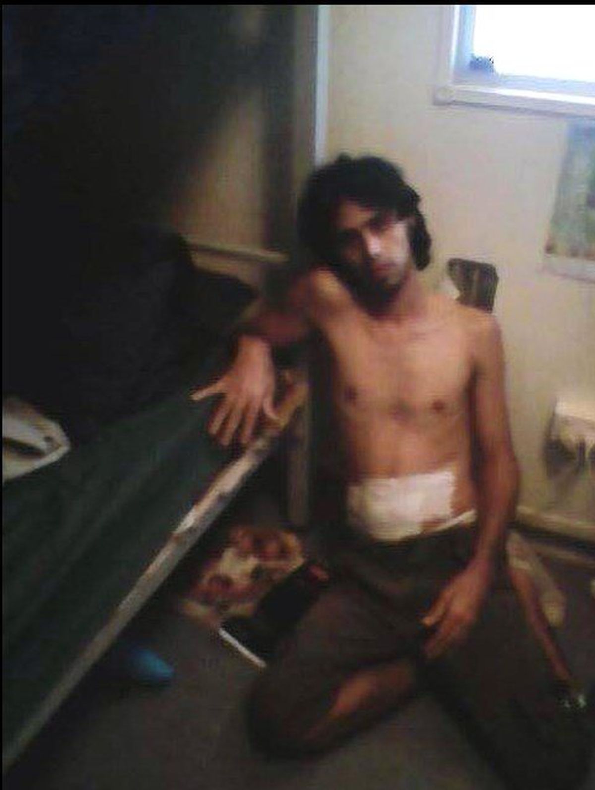 Iraklı Göçmen Boş Olduğunu Kanıtlamak İçin Midesini Kesti