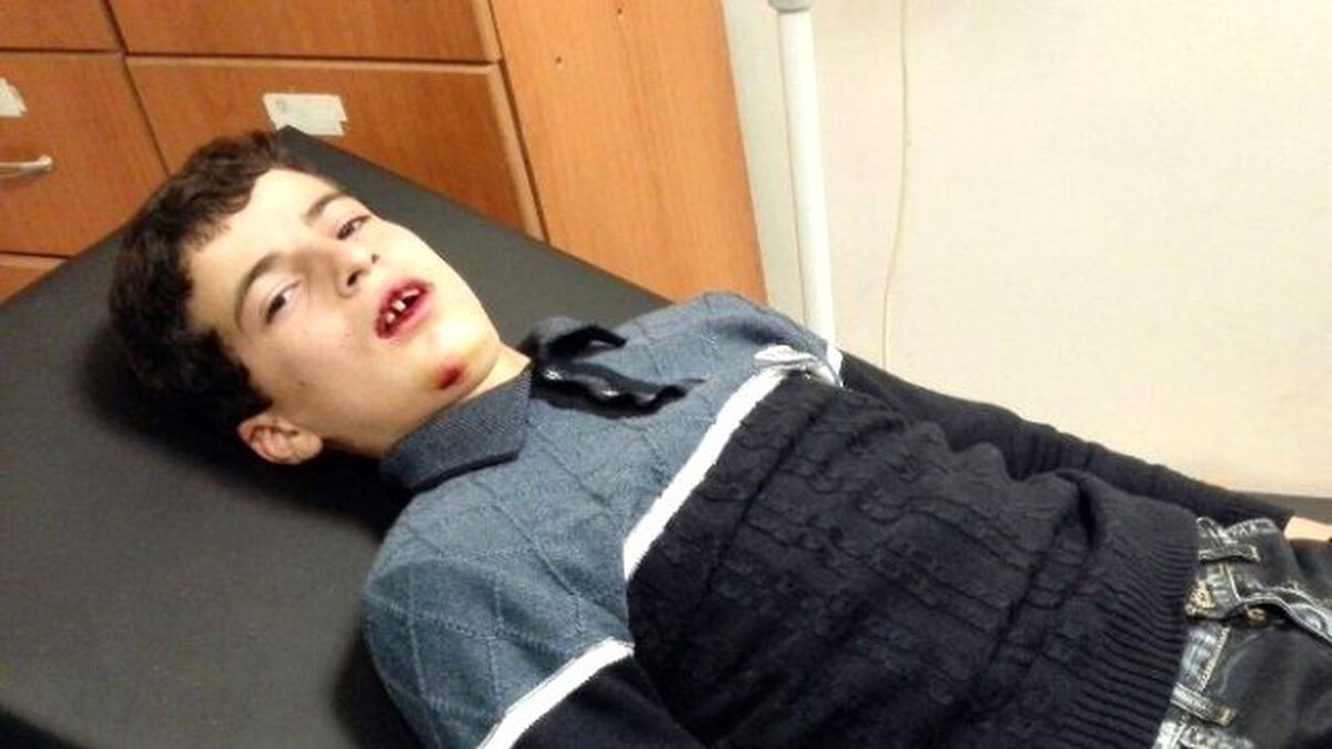 Öğretmeni Tarafından Darp Edildiği İleri Sürülen Öğrenci Hastanelik Oldu