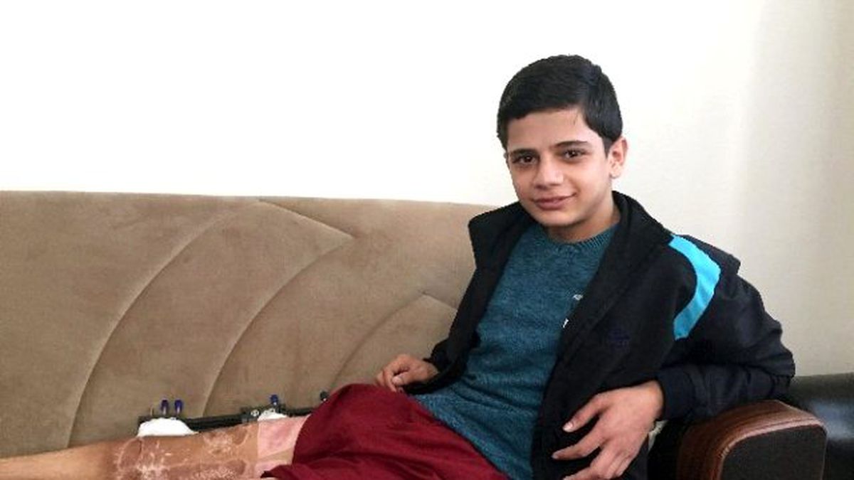 Tek Hayali Yürümek Olan Suriyeli Mohamad İlk Adımını Attı