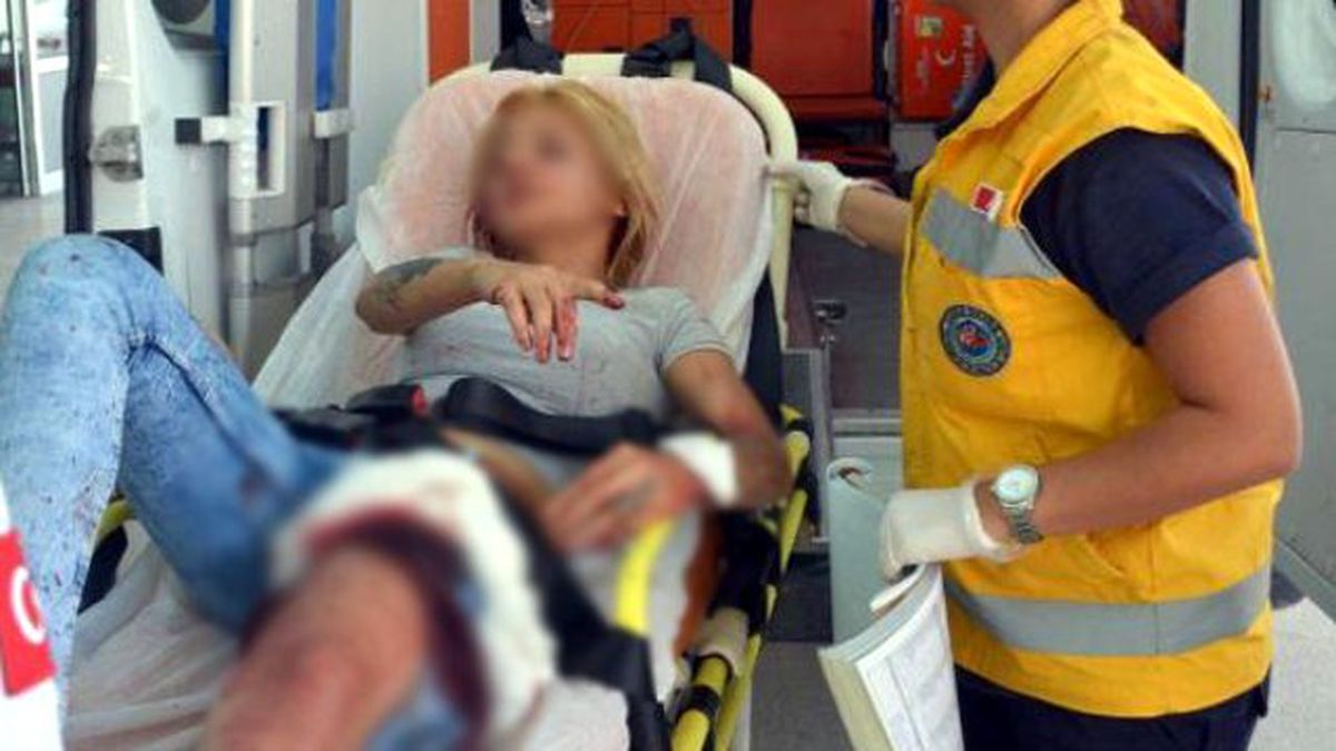 Kıskanç Sevgili, Genç Kızın Yüzünü Kesti