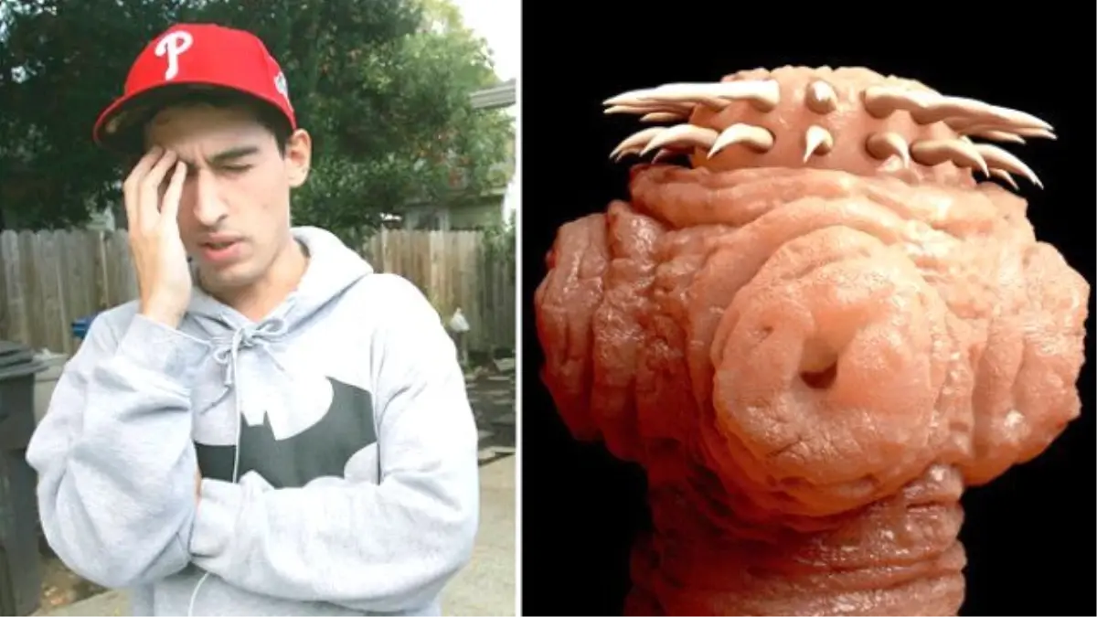 Genç Adamın Beyninden Canlı Parazit Çıktı