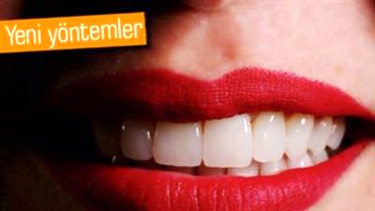 3d Yazıcılar Henüz Diş Hekimlerinin İstediği Düzeyde Değil