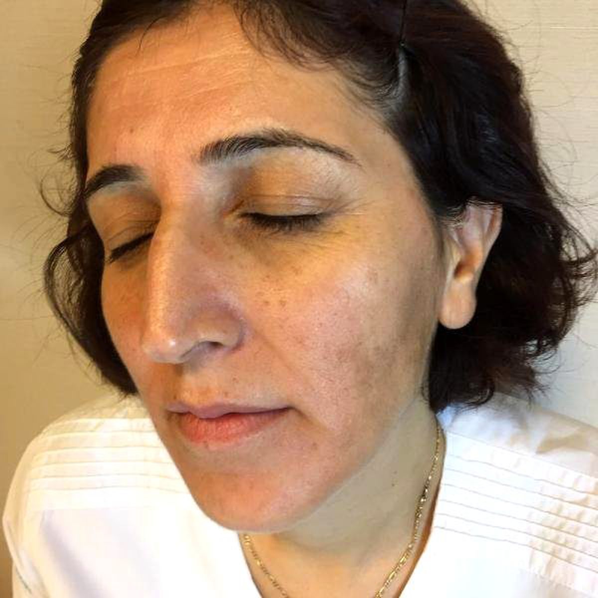 Enzimatik Peeling Maskeyle Lekesiz Cilt