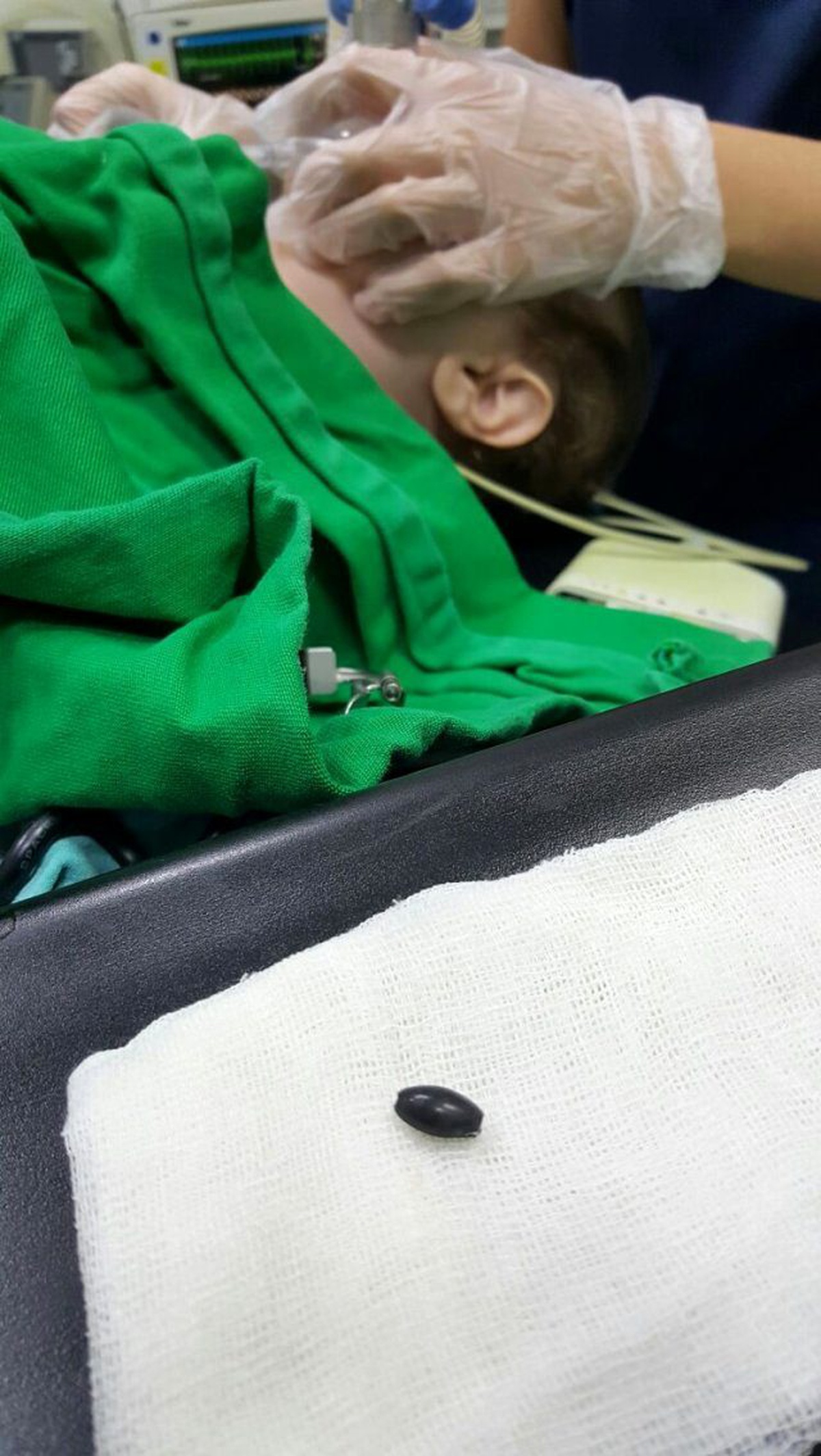 Soluk Borusuna Tespih Tanesi Kaçan Çocuk, Son Anda Kurtarıldı