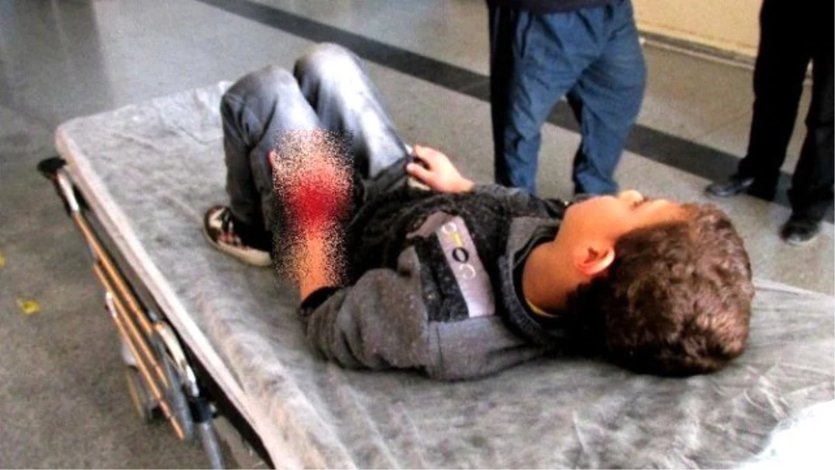 Gaziantep\'te Otomobilin Çarptığı Suriyeli Çocuk Yaralandı
