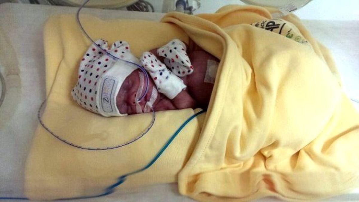 Yaşamaz Denilen Parmak Bebek 10 Aylık Oldu