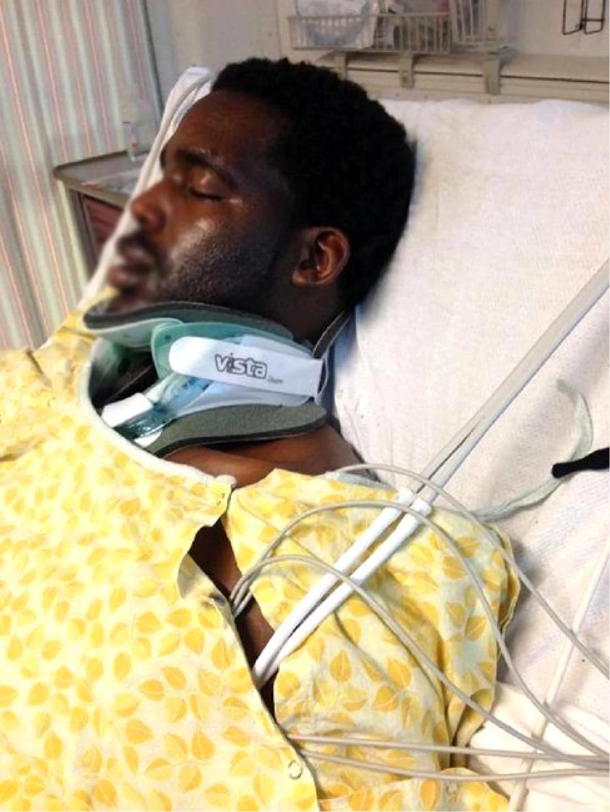 Genç Adamın Suratında Elektronik Sigara Patladı, Boynu Kırıldı
