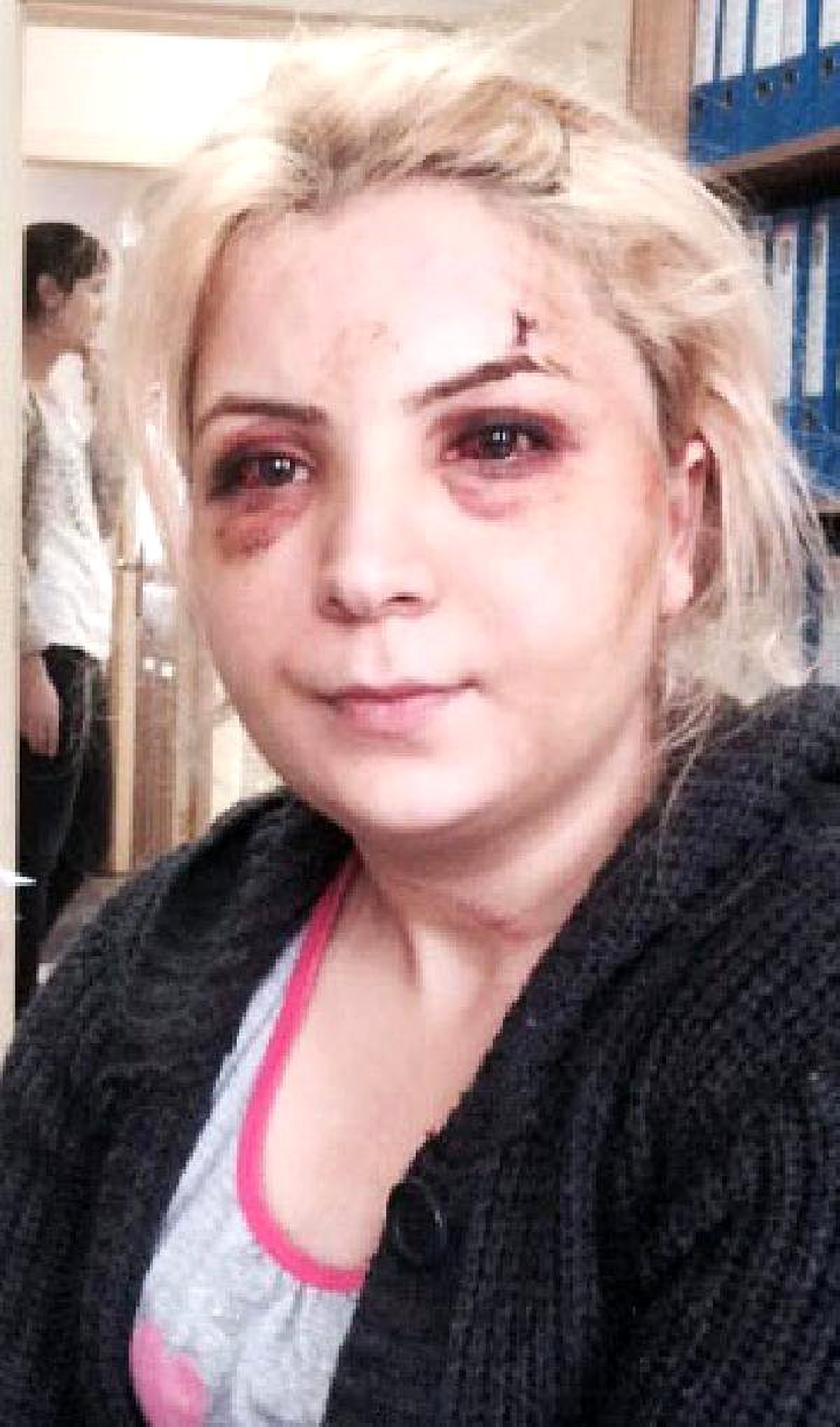 Eski Kocam Dövdü\' Diye Karakola Gitti, Cinayet Davasında Ceza Aldığı Ortaya Çıktı