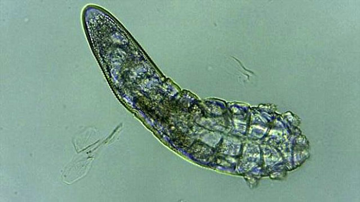 Hepimizin Yüzünde Sekiz Bacaklı Akarlar Yaşıyor!