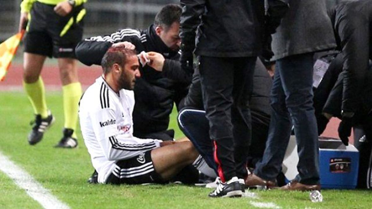 Cenk Tosun'un Başında 5 Cm Uzunluğunda Kesik Oluştu