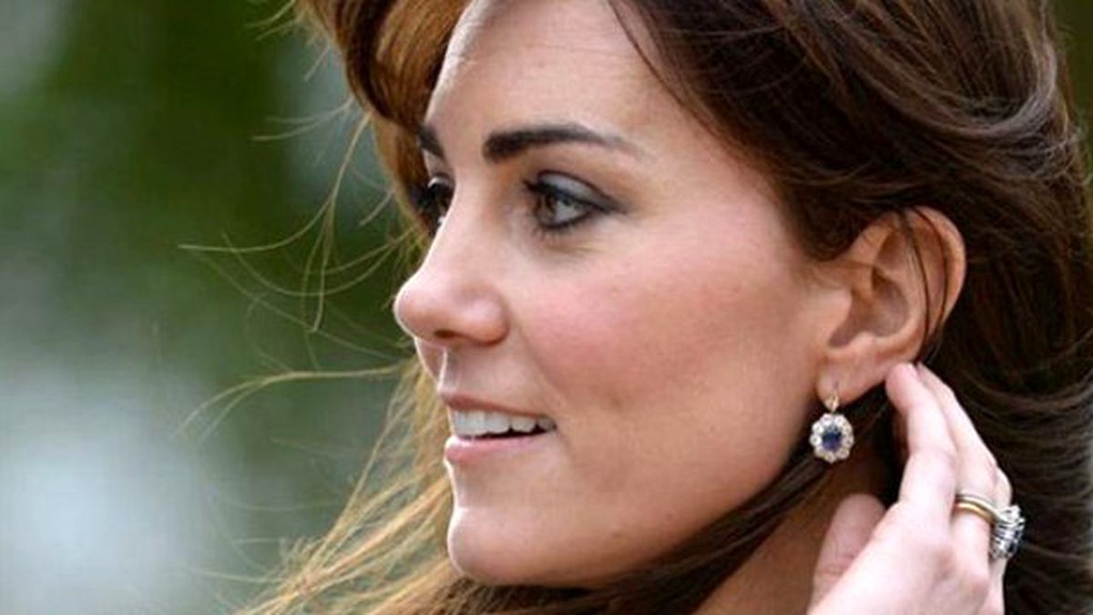 Kadınlar En Çok Kate Middleton Burnu Yaptırıyor