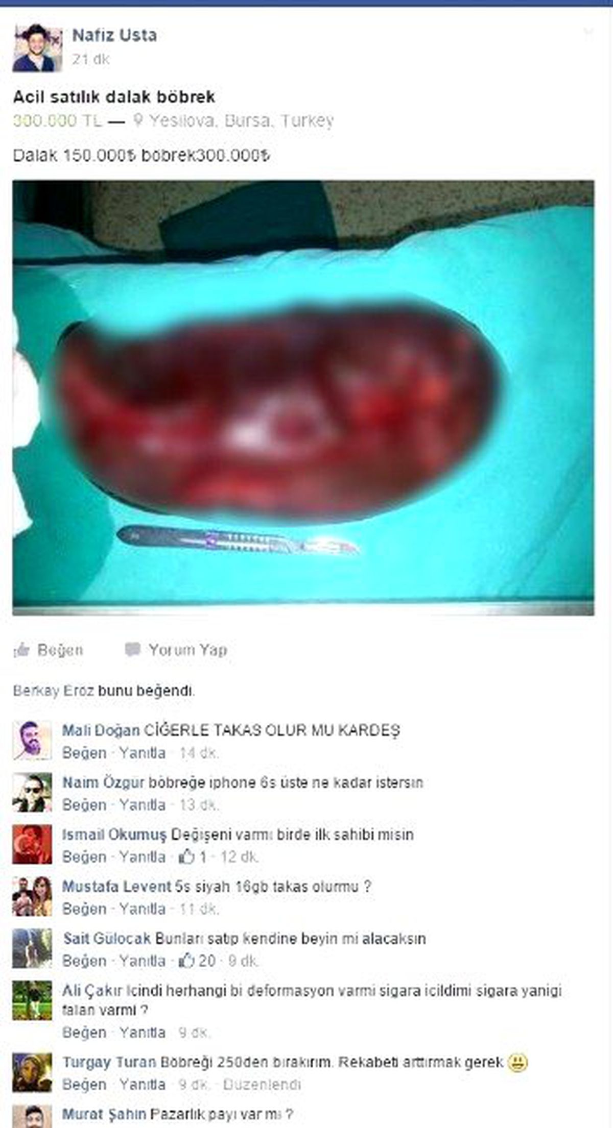 Acil Satılık Dalak Böbrek