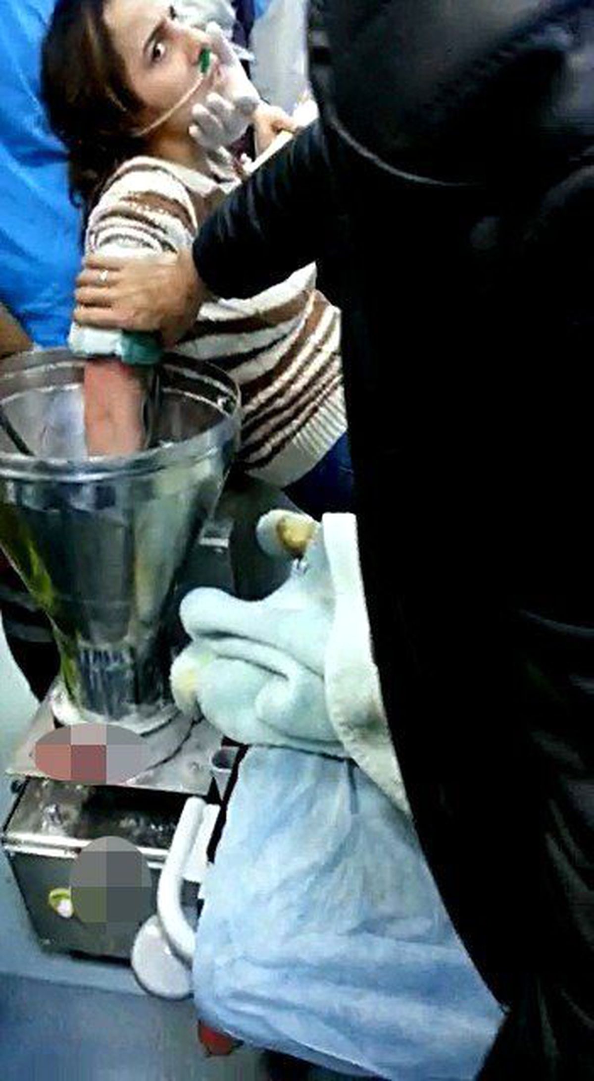 Kolunu Kaptırdığı Hamur Makinesiyle Ameliyata Alındı