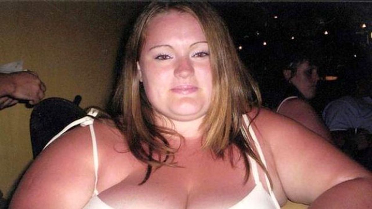 Genç Kadın, 18 Ayda 88 Kilo Verdi