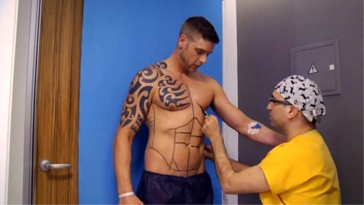 İngiliz Erkekler, Estetik Ameliyat Yaptırmak İçin İstanbul\'a Geliyor