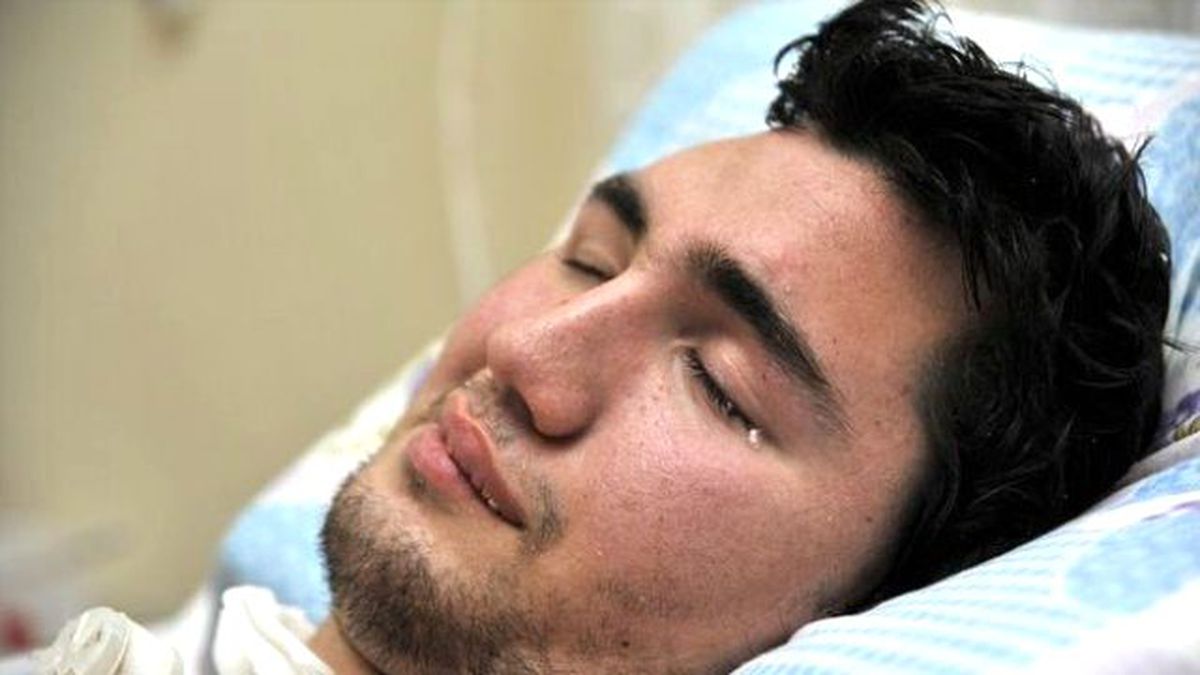 Kafatasının Bir Parçasını 1,5 Yıldır Karnında Taşıyor