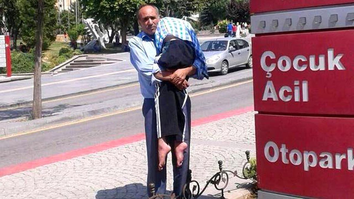 SSPE'li Çocuklar Bir Bir Ölüyor